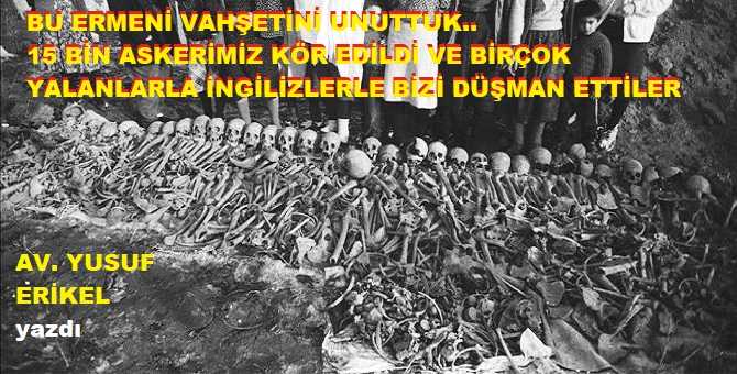 Zalim Ermenilerin bu vahşeti unutulur mu? Ama biz unuttuk.. 15 Bin askerimiz kör edildiği gibi, türlü yalanlarla bizi İngilizlerle düşman ettiler…  